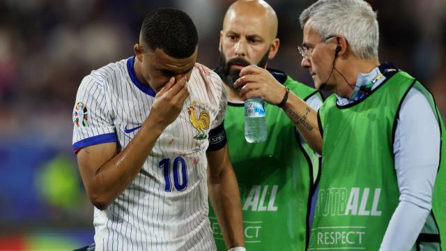 黄金甲体育官网-姆巴佩鼻骨骨折但暂无需手术 或缺席2场小组赛